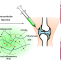 Injectable hydrogel-based drug delivery system for cartilage regeneration