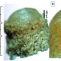 Biomimetic Gradient Scaffolds Containing Hyaluronic Acid and Sr/Zn Folates for Osteochondral Tissue Engineering